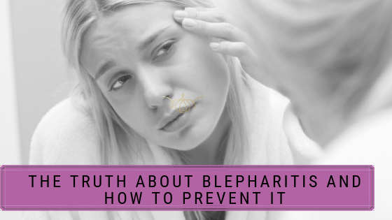 The Truth About Blepharitis And How To Prevent It